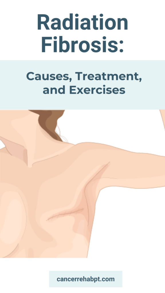 illustration of radiation fibrosis on a woman who had a mastectomy with text above "Radiation Fibrosis: Causes, Treatment, and Exercise".