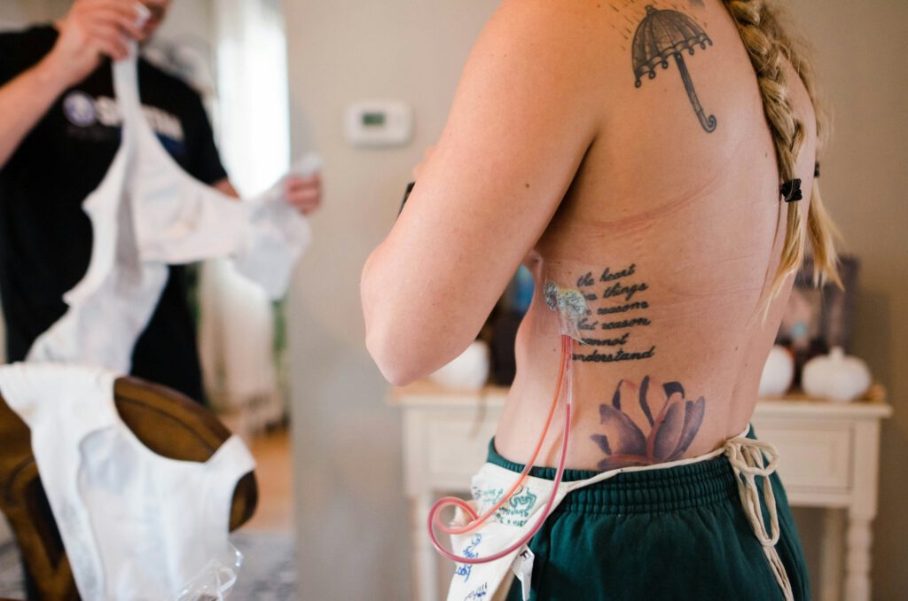 A photo of a woman after a double mastectomy procedure.