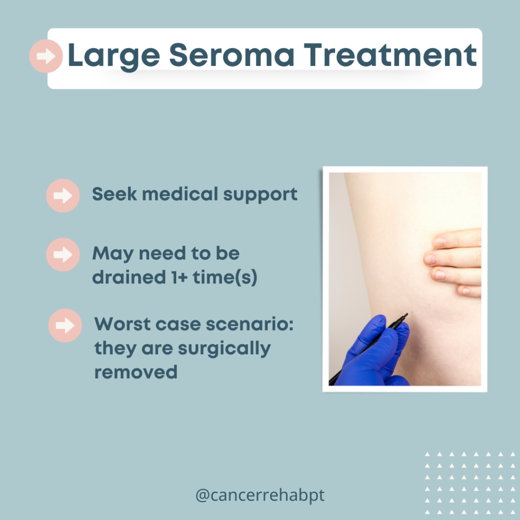 Infographic titled Seroma After Surgery: Large Seroma Treatment with three points—seek medical support, may need draining one or more times, and worst-case scenario is surgical removal. Image shows a gloved hand drawing on skin.