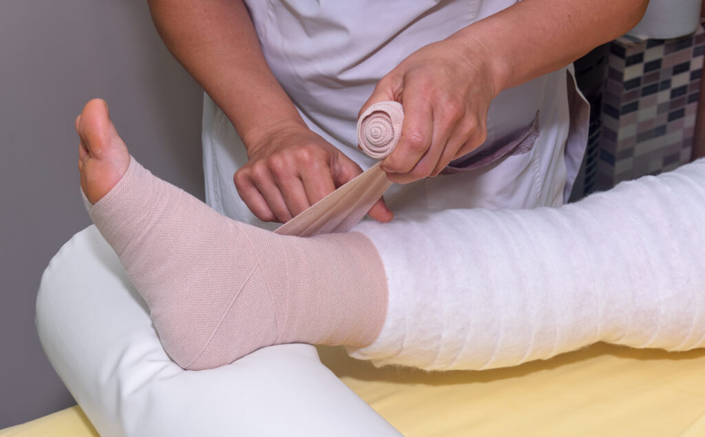 A healthcare professional wraps a patient’s leg and foot with an elastic bandage, covering white padding. The leg is resting on a cushion during the procedure.