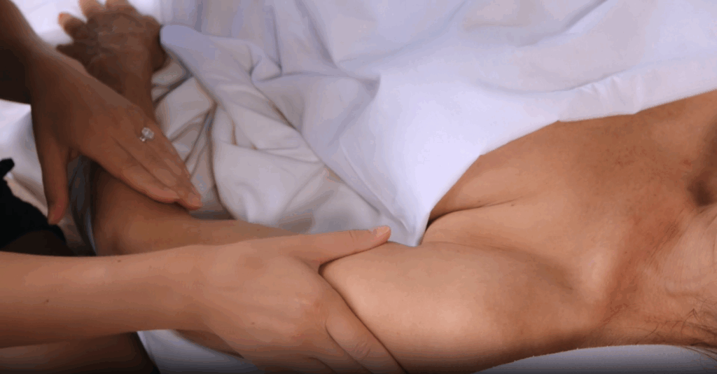 physical therapist performing manual lymphatic drainage to arm of woman lying down with white sheet