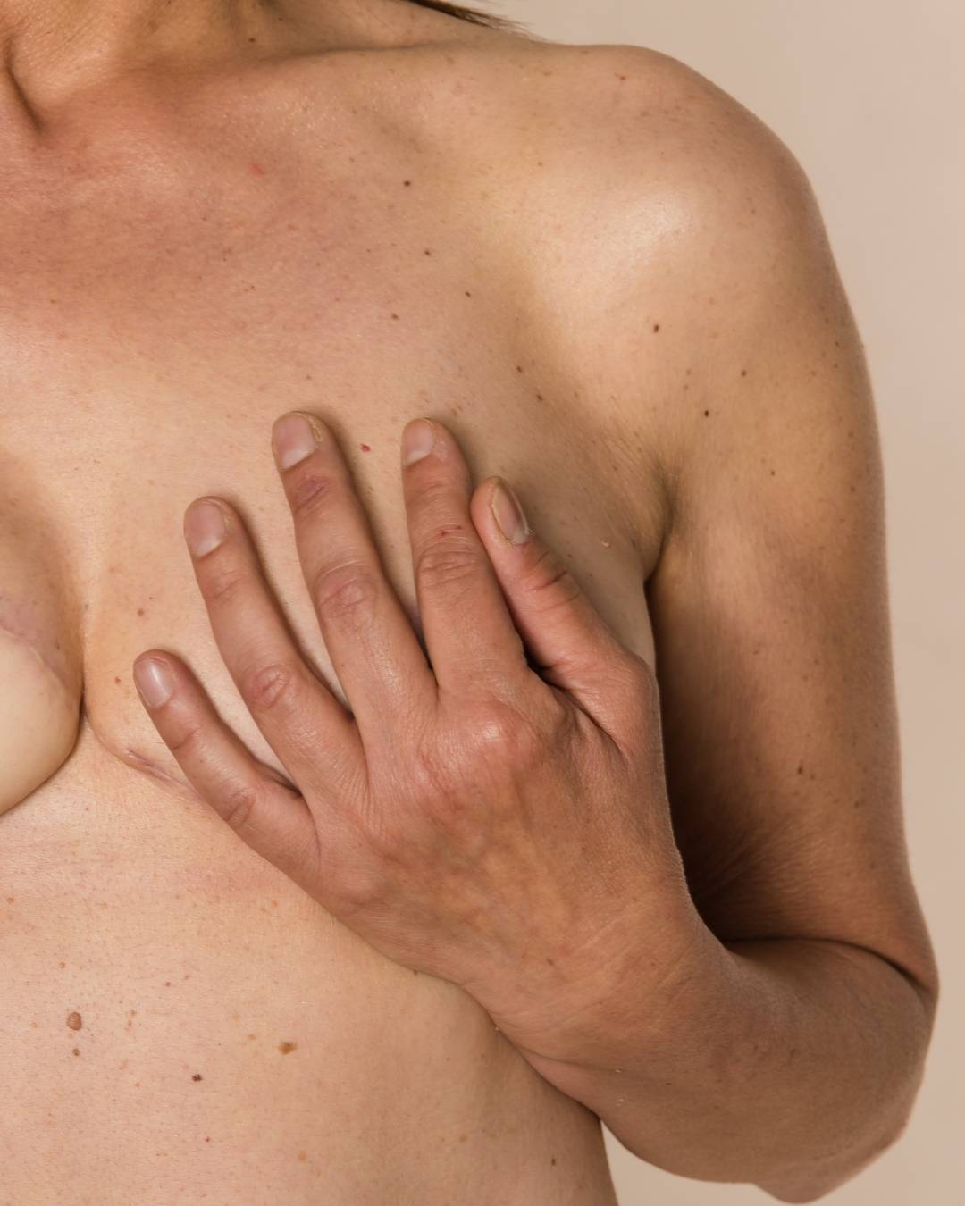 A close-up of a person’s upper body, with their hand covering their bare chest for swelling after breast surgery