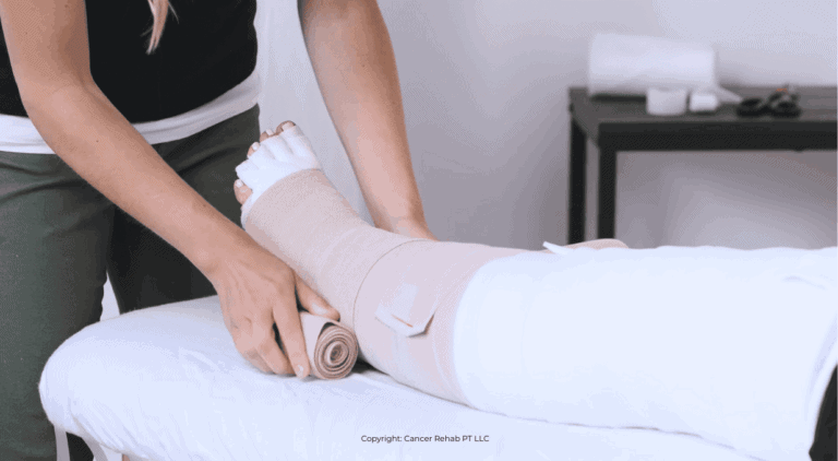 Compression Therapy: What Is It and How Does It Work?