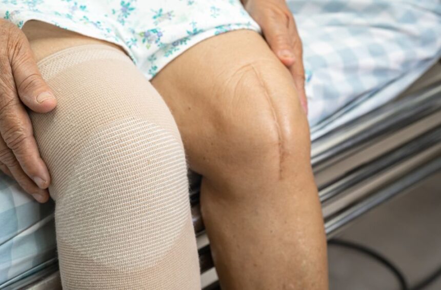 Swelling on the knee after surgery.
