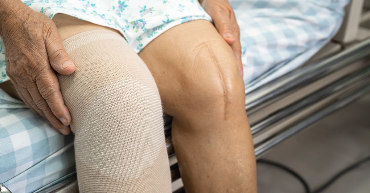 When Should I Worry About Swelling After Surgery?