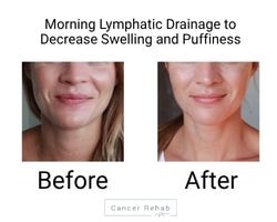 Before and after lymphatic drainage massage. Swollen face on the right side, no swelling on the left.
