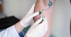 Lymphedema Surgery: What Are Your Treatment Options?