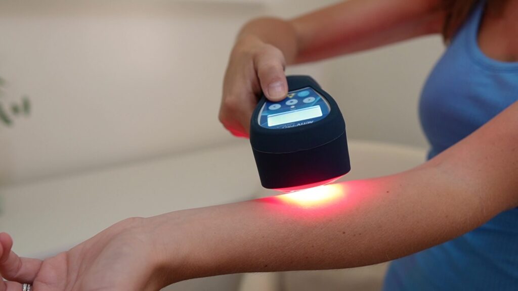 physical therapy showing low level laser on an arm