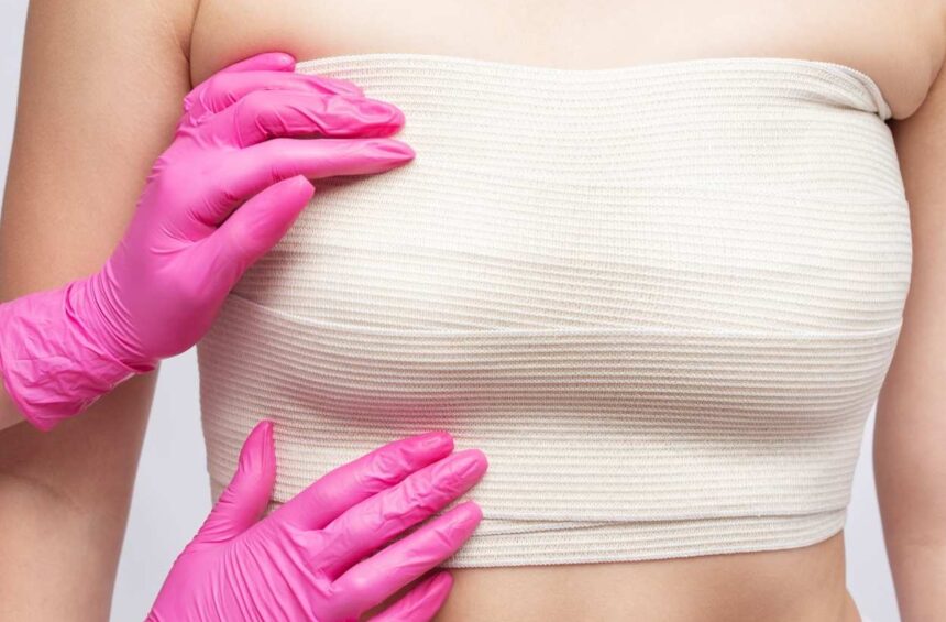 A woman after a prophylactic mastectomy.