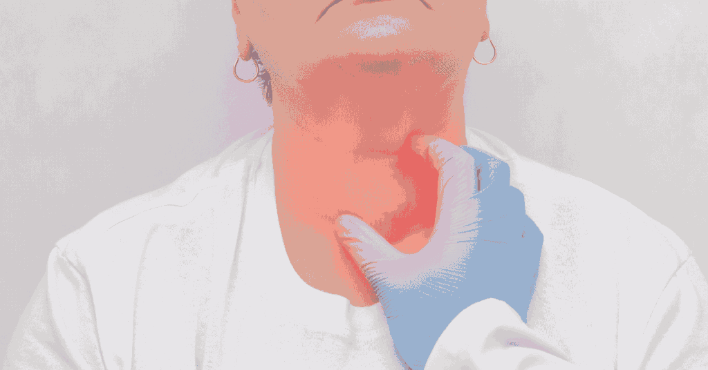 Lymphedema Neck and Head Swelling: How to Reduce It