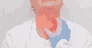 Lymphedema Neck and Head Swelling: How to Reduce It