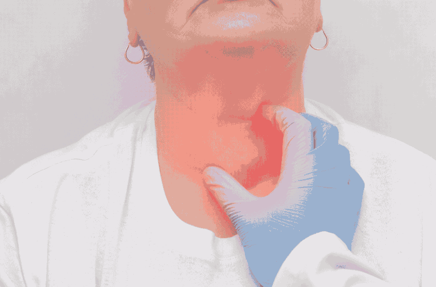 lymphedema neck and head swelling featured image.