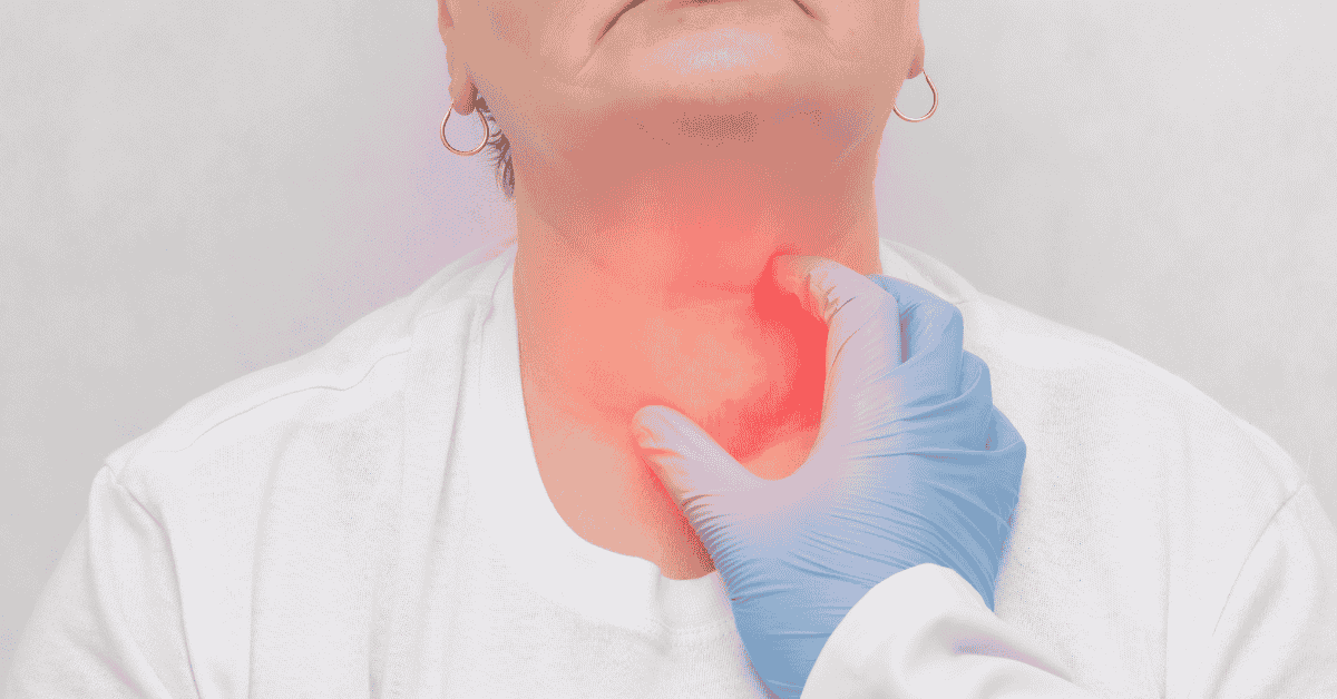lymphedema neck and head swelling featured image.