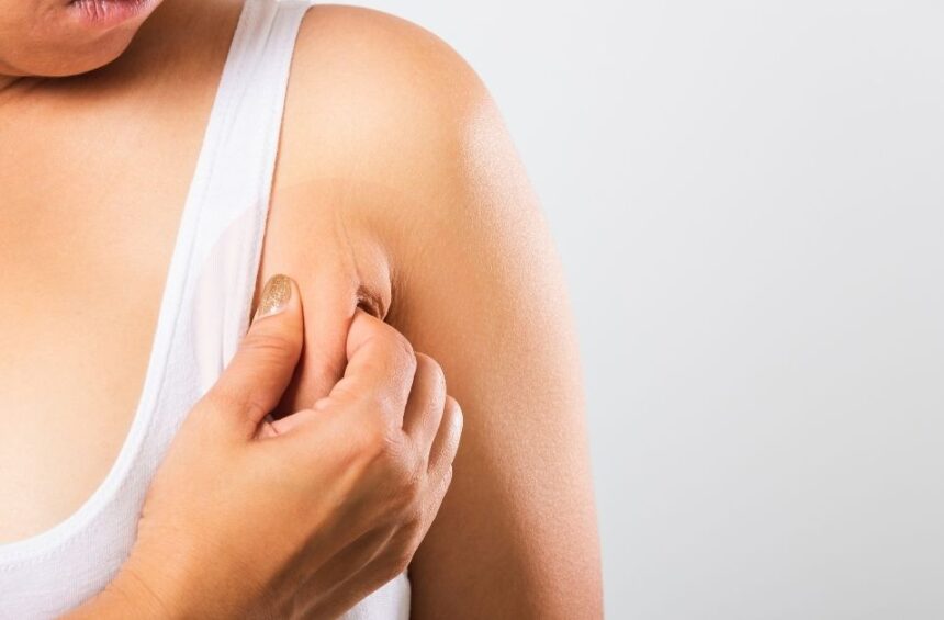 A woman looking at the armpit swelling she has.