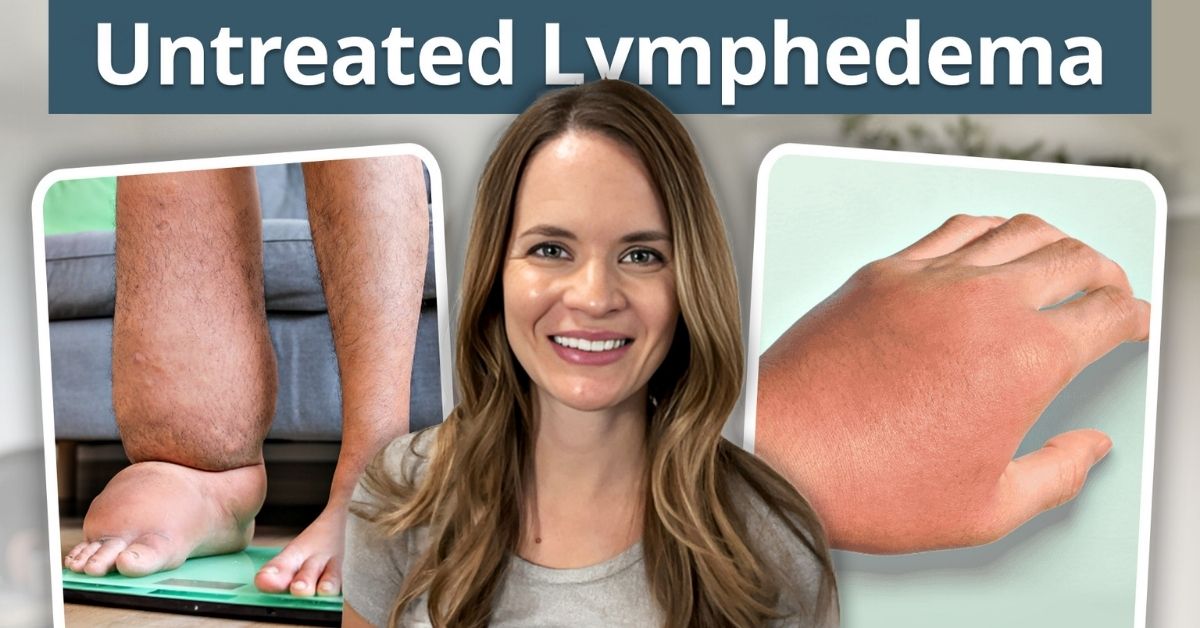 A headshot of a certified lymphedema therapist and images depicting cellulitis in a hand and stage 3 lymphedema in a leg.