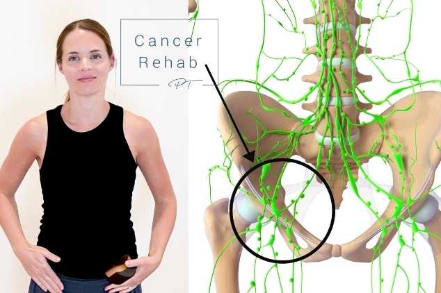 A certified lymphedema therapist demonstrating dry brushing to the groin area.