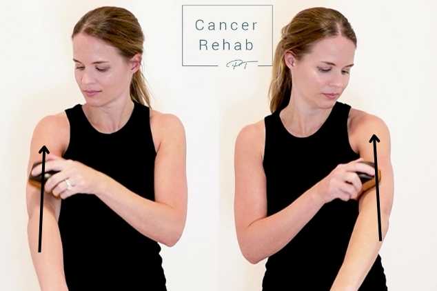 A certified lymphedema therapist demonstrating the correct direction for dry brushing the arms.